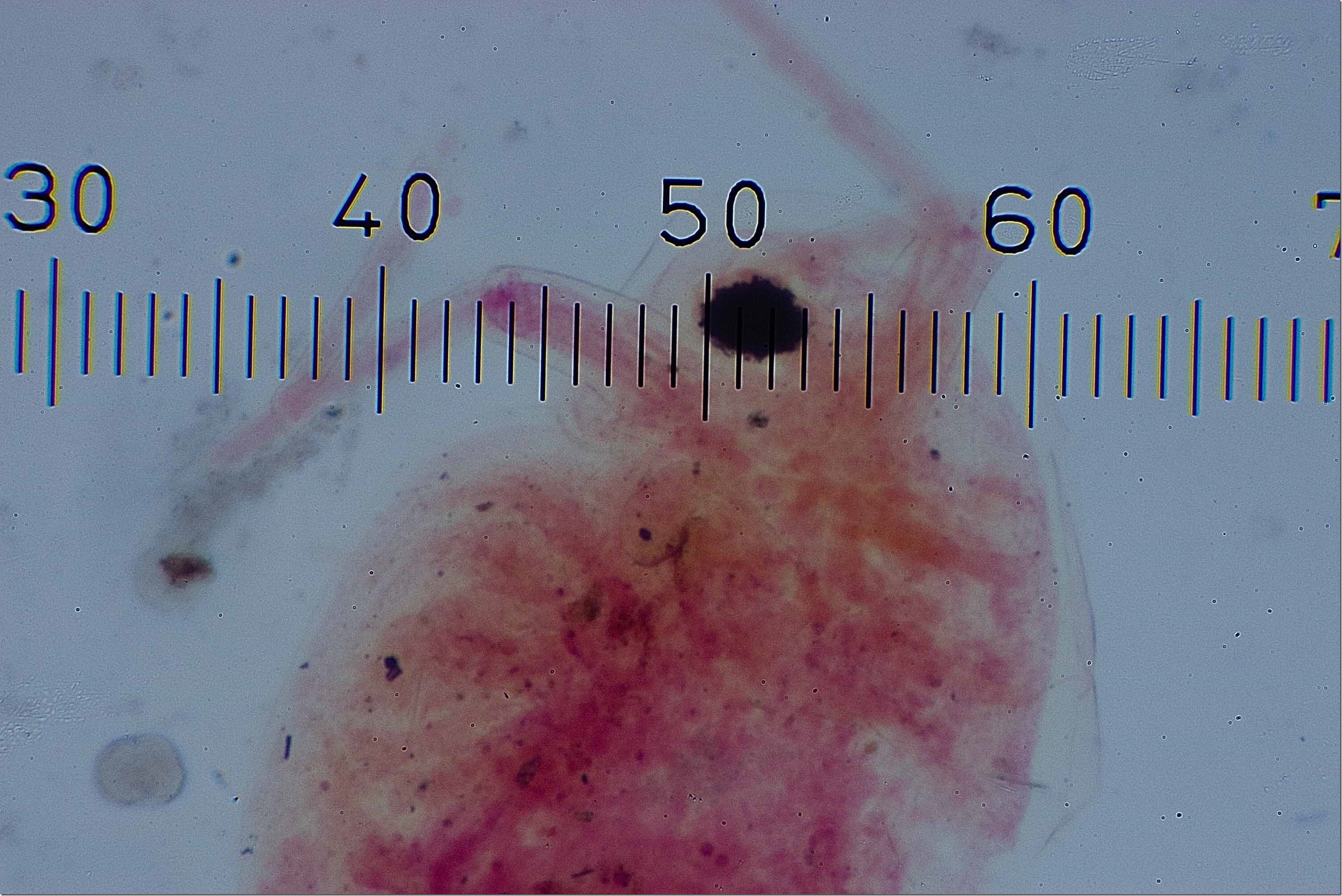 daphnia1