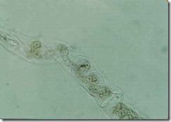 spirogyra_zygote