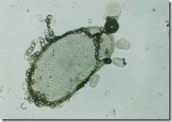 anabaena