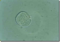 chlorella
