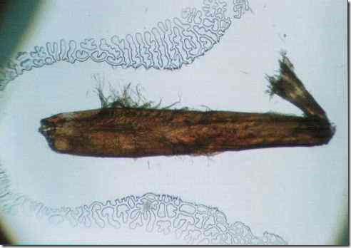 leg_of_butterfly_40
