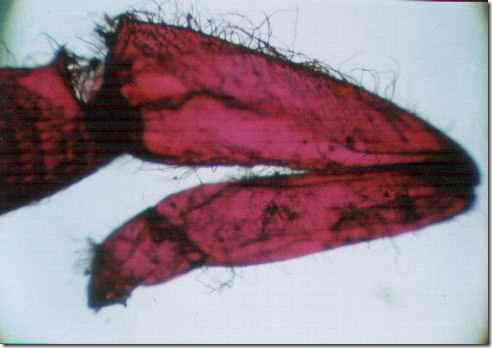 leg_of_honey_bee_40_a